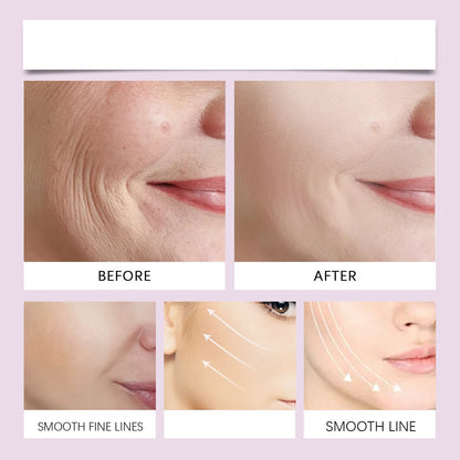 Invisible Face Lift Tape